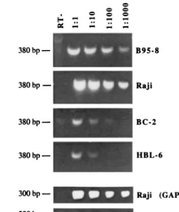 FIG. 5. EBV EBNA-1 protein expression is reduced in dually infected PELcells. Shown are Western blot analyses comparing the expression of EBNA-1 in