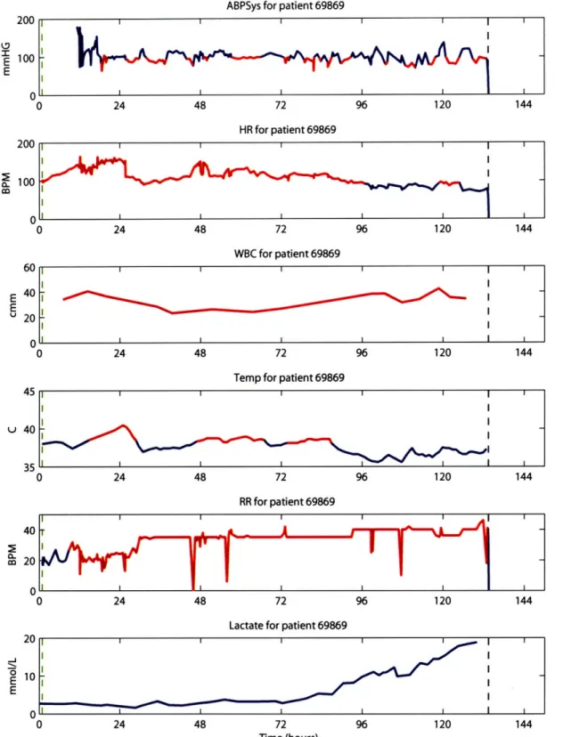 Figure  3-2:  Sample run  of the  SSOD  on patient  69869.  The patient entered  the ICU  with an elevated heart  rate,  but  was  neither  febrile  nor  hyperventilating