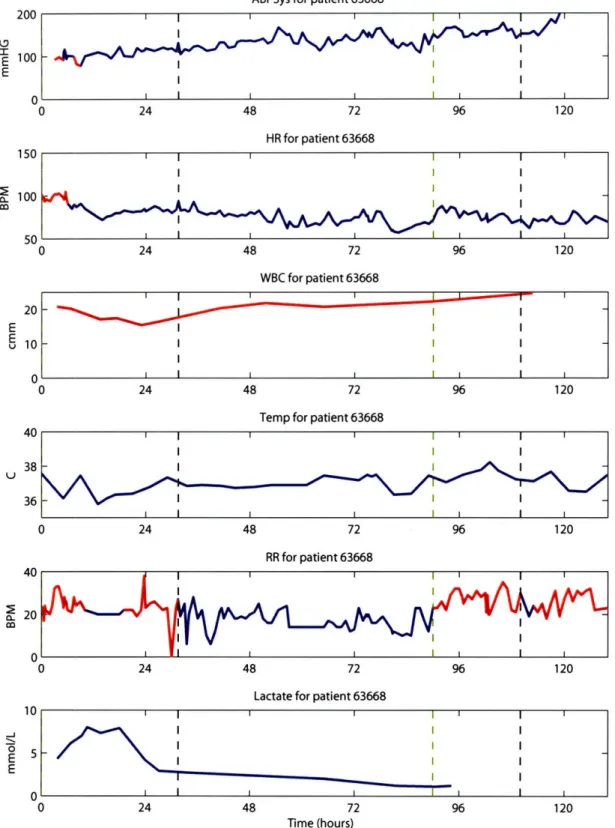 Figure  3-3:  Sample  run  of  the  SSOD  on  patient  63668.  The  patient  entered  the  unit  with  an elevated  heart  rate  and  respiratory  rate