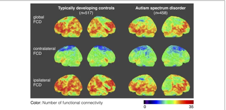 FIGURE 2 | Average maps of functional connectivity densities for the typically developing controls (TDCs) and autism spectrum disorders (ASDs).