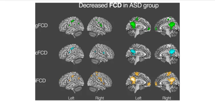 FIGURE 3 | Decreased functional connectivity density (FCD) in autism spectrum disorder (ASD) group