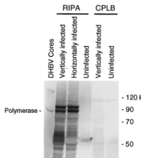 FIG. 5. The polymerase exists in multiple electrophoretic forms. (A) Non-encapsidated polymerase was immunoprecipitated from liver or LMH cells with