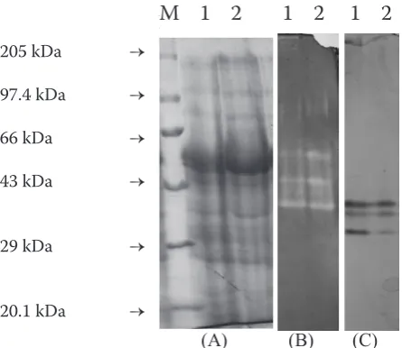 Figure 1. SDS-PAGE protein profile (A), super oxide dismutase (B) and esterase (C) of Stylosanthes hamata grown under ambient (C360) and elevated (C600) CO2 environment