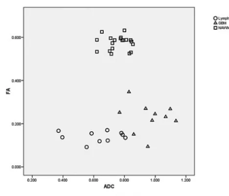 Fig 2. ADC and FA measurements in a 45-year-old woman with pathologically confirmed GBM in the left frontal region.an enhancing mass in the left frontal region