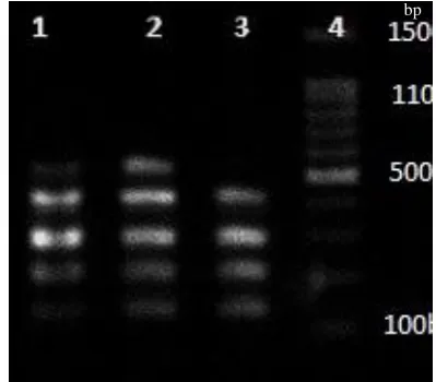 Fig. 4. The PCR products of genes. Lanes 1 and 2, clfA, clfB, fnbA, fnbB, and fib clfA (288 bp), clfB (204 bp), fnbA (128 