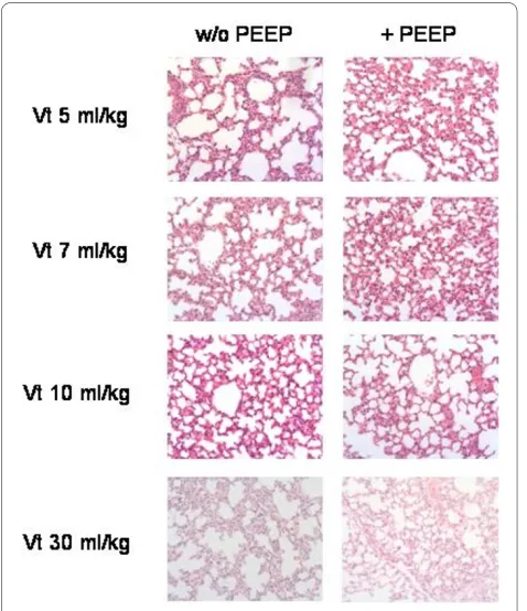 Figure 4 Histological sections of lung parenchyma after mechan-ical ventilation with different tidal volumes without and with ap-plication of PEEP