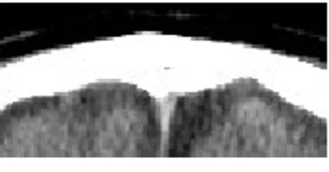 Figure 8 displays the entire process. The results of the