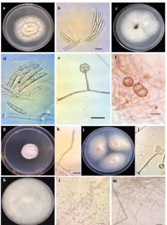 Figure 5. µm, e=50 µm) phialid and spores; Fusarium merismoides: a) colony incubated for 60 days at 25°C grown on Potato Dextrose Agar (PDA), b) macroconidia; Fusarium solani: c) colony incubated for 5 days at 25°C grown on PDA, d) macroconidia, e) false head, f) chlamidospore; Acremonium persicinum: g) colony incubated for 10 days at 25°C grown on PDA, h) phialid and spores; Acremonium zonatum: i) colony incubated for 10 days at 25°C grown on PDA, j) Mucor racemosus: k) colony incubated for 5 days at 25°C grown on PDA, l-m) sporangium and sporangiospores (scale bars=10  