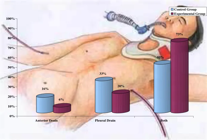 Fig. 5 Percentage Distribution of the Type of Chest Drain Tube in Control and Experimental group of Patients 