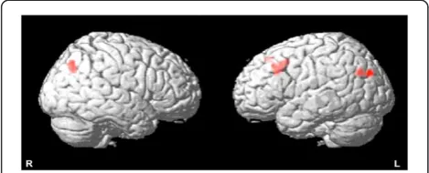 Figure 2 Spatial distribution of functional brain MRI activation.