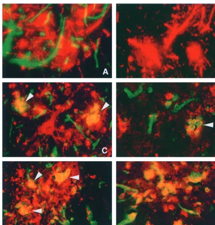 FIG. 1. Double immunoﬂuorescence microscopy in the CNS of C57BL/6 mice (A, C, D, E, and F) and B2m-KO mice (B) after infection with NSV