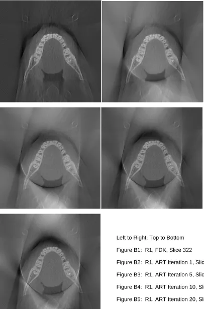 Figure B5:  R1, ART Iteration 20, Slice 322 