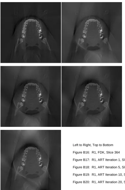 Figure B20:  R1, ART Iteration 20, Slice 364 