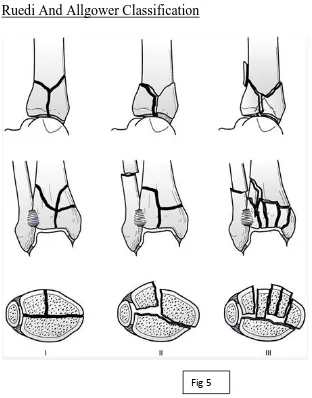   Fig 5 