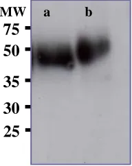 Fig. 2.  Detection and comparison of CD147 (EMMPRIN) in normal and osteoarthritis human articular cartilage