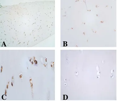 Fig. 1. Immunoreactivity of mAb anti-CD147, 8G6, in normal and osteoarthritis human articular cartilage sections
