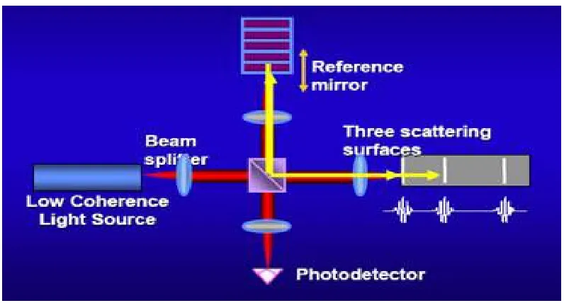 Fig 1   OPTICAL COHERENCE TOMOGRAPHY 
