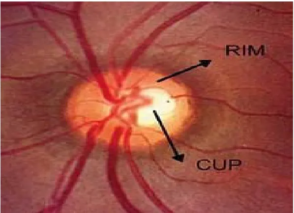 Fig 4   MACULA AND PERIPHERAL RETINA 