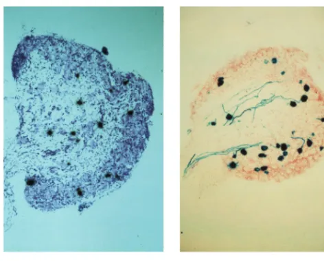 FIG. 11. LAT and lacZpR20.9/43. Mice were footpad inoculated, and 1 month later DRG sections wereeither probed for LAT expression (see Materials and Methods; section wascounterstained with thionin) or stained with X-Gal (section was counterstained are expressed in similar numbers of cells with 1764/with neutral red).