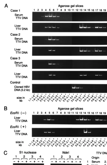 FIG. 1. (A) Separation of TTV DNAs extracted from serum or liver tissues by gel electrophoresis