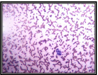 Fig -4.Hashimoto thyroiditis :TIC smear shows Syncytial cluster of hurthle cells showing abundant cytoplasm with anisokaryosis  H&Ex400 (CY263/12) 