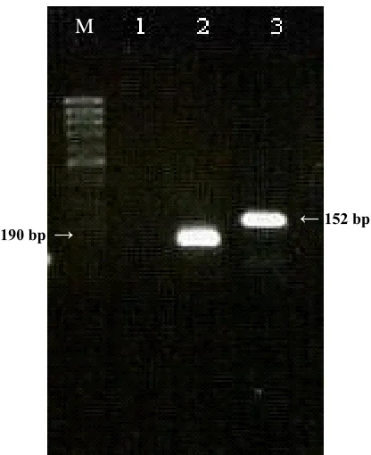 Fig. 3.  Subtyping of avian influenza viruses in cloacal and trachealCinnaGen, Iran) lane 1, H2O control and lanes 2, ten µl of Multiplex RT-PCR products obtained by using primers specific to HA genes of the H5N1 and H9N2 viruses