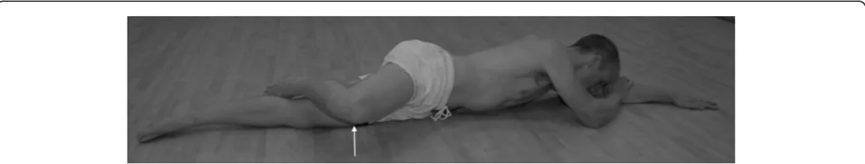 Figure 2 The bottom leg is kept in line with the trunk and thetop leg is flexed at the hip with the toes placed behind thelower knee