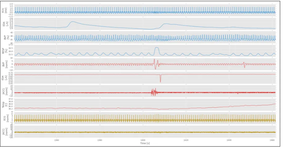 Figure 4.2: A 120 seconds length segment of WCS signals. Blue: signals collected withmedical-grade device (FlexComp); Red: signals collected with Empatica E4; Yellow: sig-nals collected with ComfTech HeartBand