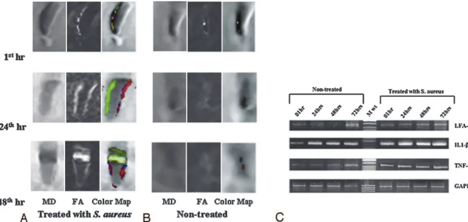 Fig 5. Cell aggregation at different time points in nontreated (A–C) and heat-killed S aureus–treated (D–F) cell lines
