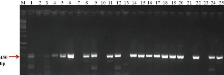 Fig. 1: Representative picture of PCR amplification for 3: SK-980; 4: SK-935; 5: SK-223; 6: 4N1; 7: 4A6; 8: 4J2; 9: 4J4; 10: 4C3; 11: 4M2; 12: 4Q5; 13: SK-711; 14: SK-921; 15: SK-219; 16: SK-1;cry1-type genes in Bt isolates and strains