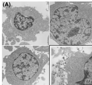FIG. 4. Electron microscopy of H9sample (magniﬁcation,LAI cells cultured in the absence (A) or presence (B) of 60 �M PNAPR2
