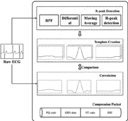 Figure 2. Block diagram for proposed template matching-based ECG compression process