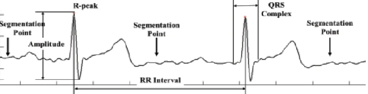 Figure  6. Segmentation point, with exception of three divided parts 3.2 Evaluation results of segmentation template matching compression algorithm