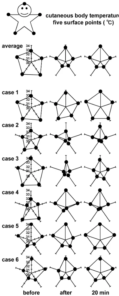 Figure 4(a)and noradrenaline are known to be elevated under condi- 