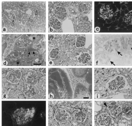 FIG. 4. Representative kidney pathology of hybridoma-transplanted mice. (a) (BALB/c �representative glomerulus from a SCID mouse transplanted with hybridoma 37C4.1