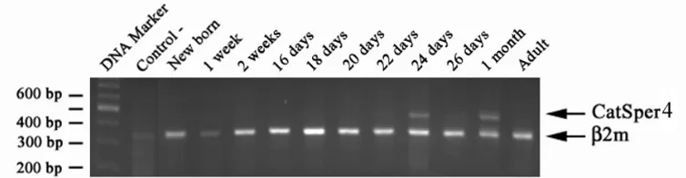 Fig. 1.  Postnatal time-course analysis of mouse CatSper3 and ß2m gene expression in mouse testis