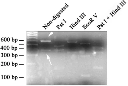 Fig. 3.  Restriction enzymatic digestion of PCR products of CatSper3 and its corresponding shorter form by different restriction enzymes