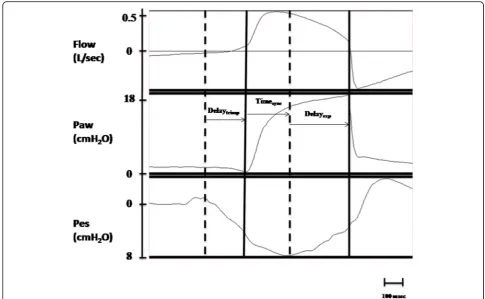 Fig. 2 Example from a real patient tracing (from our database) of patient-ventilator interaction measurements during NIV