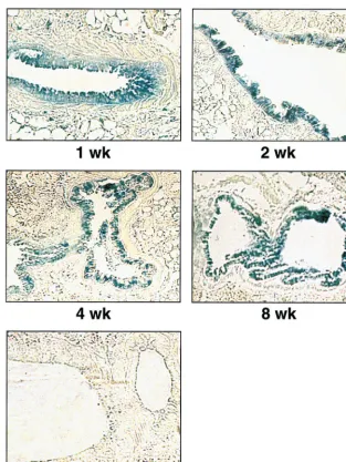 FIG. 6. �Control panel shows a lung section of a mouse inoculated with the pKUNrep2 DNA