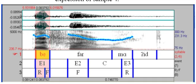 Figure 3: The spectrograph of the first peak  [befarmΑ?id] for a neutral 