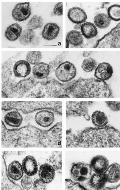 FIG. 4. Analysis of virion morphology by electron microscopy. Jurkat cells were transfected with proviral DNAs; 14 days later, cells were ﬁxed, stained, embedded,and visualized by electron microscopy