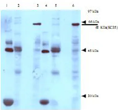 Fig. 1. Western-blotting of GST-ORF P pulldown with an antibody against SC35. GST pulldown extracts were run on a 12.5% SDS-PAGE and analyzed by Western-blotting using an antibody against SC35