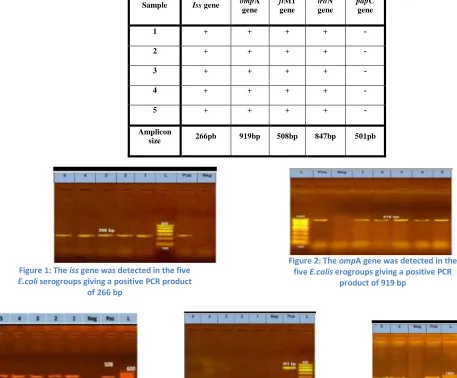 Figure 2: The ompA gene was detected in the 