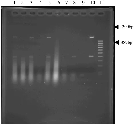 Fig.  1.  Multiplex PCR amplification of 16s RNA region 
