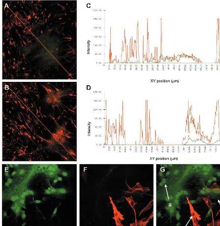 FIG. 2. Effect of MVeGFP infection on the GFAP and vimentin cytoskeleton. U-251 cells were infected, ﬁxed, and examined by CSLM for autoﬂuorescence andimmunoreactivity, as described for Fig