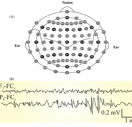Figure 4 (A) International 10-20 EEG Electrode Placement System. (B) Two EEG Traces  Example with a Burst of Epileptiform Activity on the Posterior Right Side