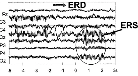 Figure 5 Mu Rhythm, Event Related Desynchronization, and Synchronization [11] 
