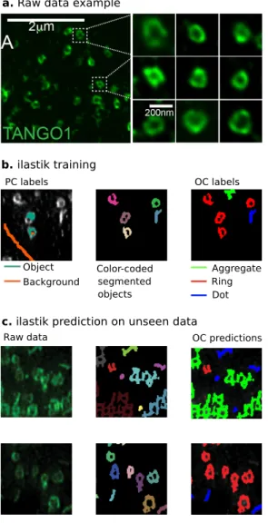 Fig. 3. A combination of pixel and object classification workflows. The first steps of the image-processing pipeline, involving deconvolution and z-projection, are not shown