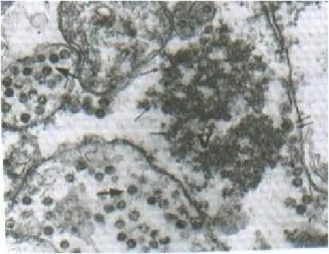 Fig. 1. Electron micrograph of thin sections of infected cellsat 12 h p.i.double layered particle at the stage of budding through the ER(double arrows) and the mature particles in the lumen of the ER(large arrows) can be seen