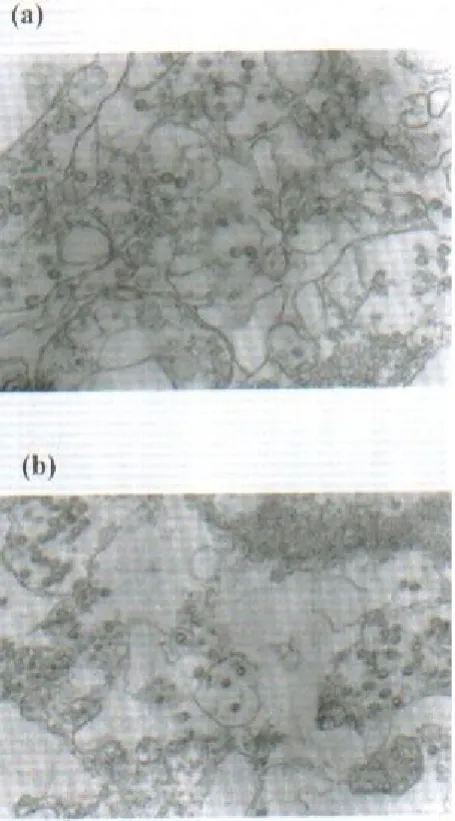 Fig. 5. Immunogold controls.pre-immune rabbit serum (with Ab to VP6 after adsorption in the presence of excess Ag( (a), SA11–infected cells with 55,000); (b), SA11–infected cells 40000).